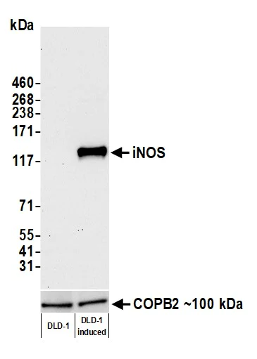 Western blot - Anti-iNOS antibody [BLR188J] - BSA free (AB314088)