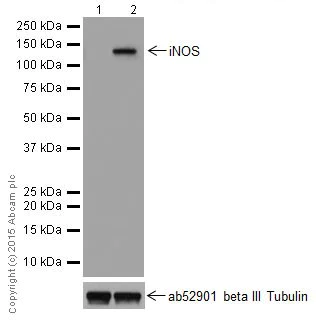 Western blot - Anti-iNOS antibody [EPR16630] (AB205529)