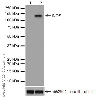 Western blot - Anti-iNOS antibody [EPR16630] - BSA and Azide free (AB251432), expandable thumbnail