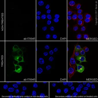 Immunocytochemistry/ Immunofluorescence - Anti-iNOS antibody [EPR16635] (AB178945)