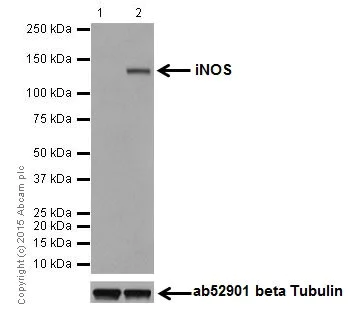 Western blot - Anti-iNOS antibody [EPR16635] (AB178945)
