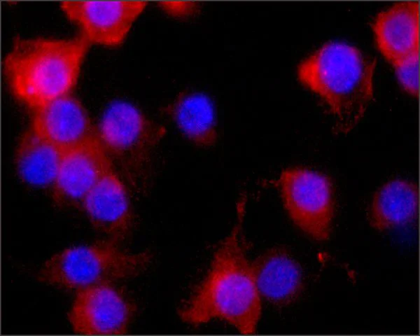 Immunocytochemistry/ Immunofluorescence - Anti-iNOS antibody [NOS-IN] (AB49999)
