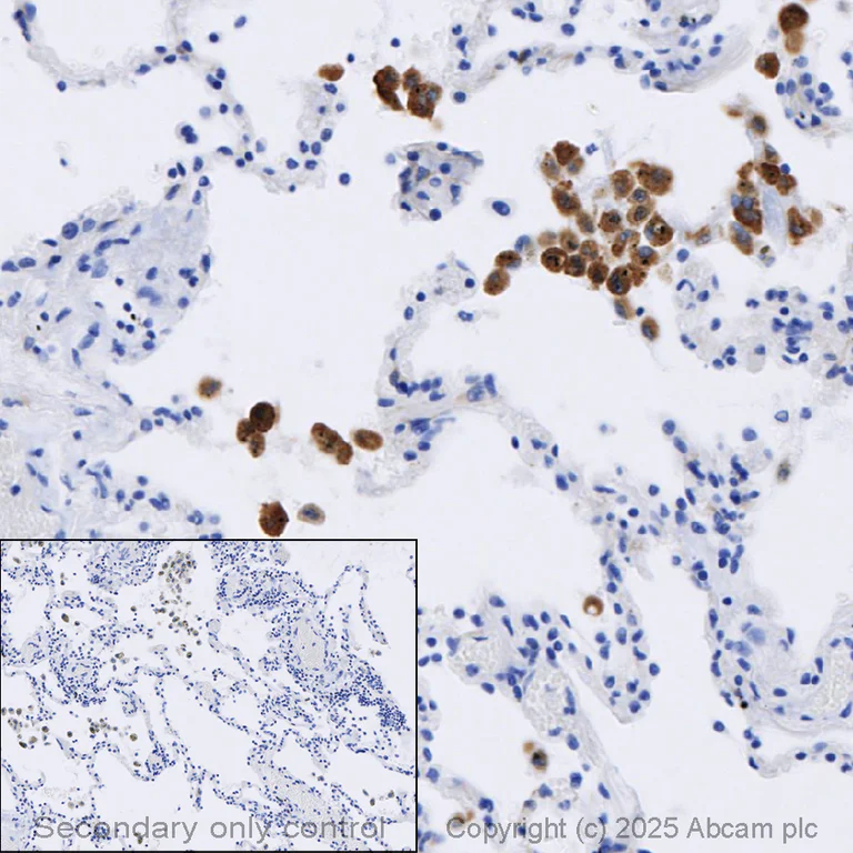 Immunohistochemistry (Formalin/PFA-fixed paraffin-embedded sections) - Anti-iNOS antibody [RM1017] (AB283655)