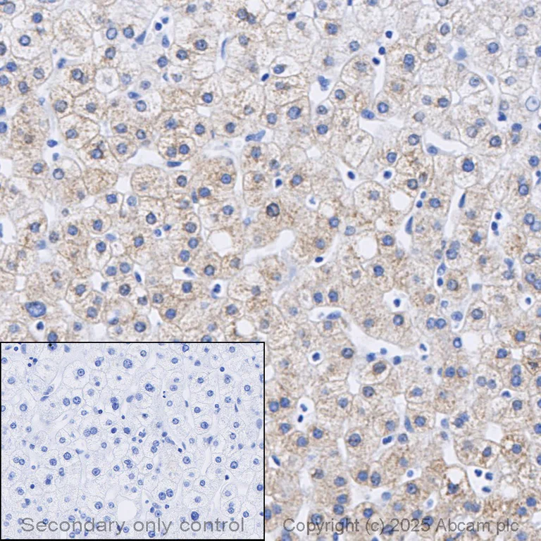 Immunohistochemistry (Formalin/PFA-fixed paraffin-embedded sections) - Anti-iNOS antibody [RM1017] (AB283655)