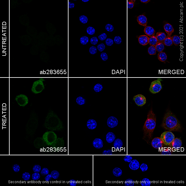 Immunocytochemistry/ Immunofluorescence - Anti-iNOS antibody [RM1017] - BSA and Azide free (ab283668), expandable thumbnail