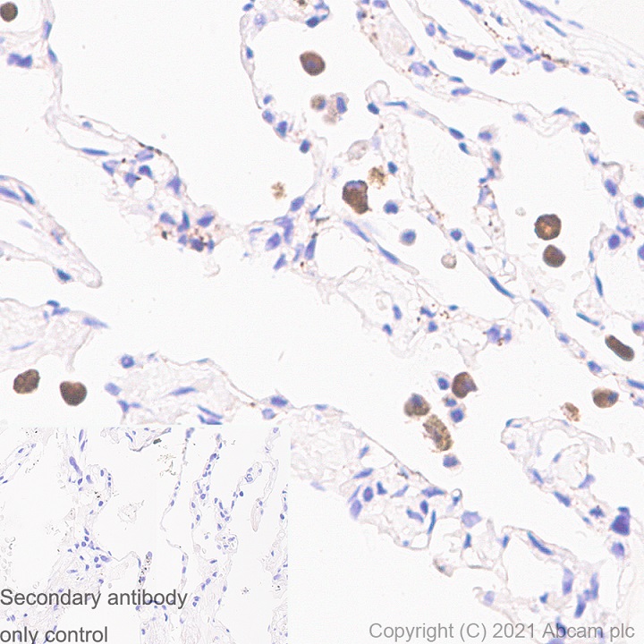Immunohistochemistry (Formalin/PFA-fixed paraffin-embedded sections) - Anti-iNOS antibody [RM1017] - BSA and Azide free (AB283668), expandable thumbnail