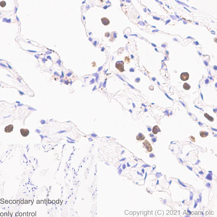 Immunohistochemistry (Formalin/PFA-fixed paraffin-embedded sections) - Anti-iNOS antibody [RM1017] - BSA and Azide free (AB283668)