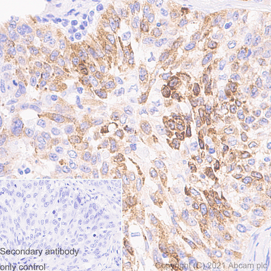 Immunohistochemistry (Formalin/PFA-fixed paraffin-embedded sections) - Anti-iNOS antibody [RM1017] - BSA and Azide free (AB283668), expandable thumbnail