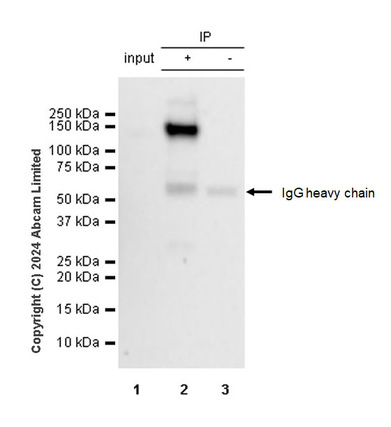 Immunoprecipitation - Anti-iNOS antibody [RM1017] - BSA and Azide free (ab283668), expandable thumbnail