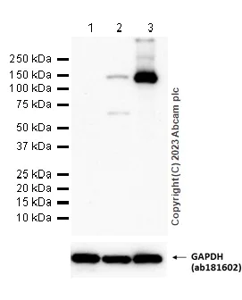 Western blot - Anti-iNOS antibody [RM1017] - BSA and Azide free (AB283668)