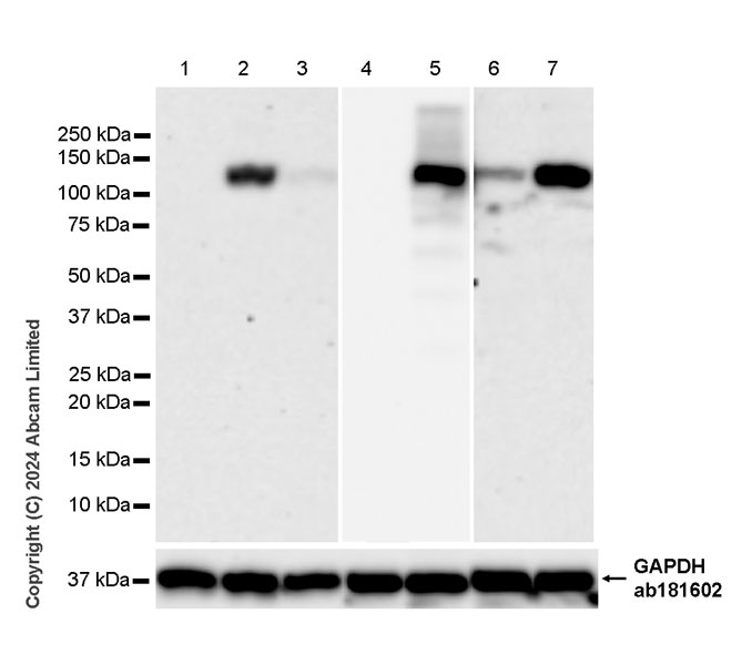 Western blot - Anti-iNOS antibody [RM1017] - BSA and Azide free (ab283668), expandable thumbnail