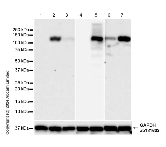 Western blot - Anti-iNOS antibody [RM1017] - BSA and Azide free (AB283668)