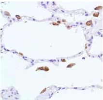 Immunohistochemistry (Formalin/PFA-fixed paraffin-embedded sections) - Anti-iNOS antibody [SP126] - BSA and Azide free (AB239990)