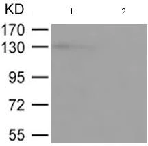 Western blot - Anti-iNOS (phospho Y151) antibody (AB182640)