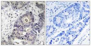 Immunohistochemistry (Formalin/PFA-fixed paraffin-embedded sections) - Anti-iNOS (phospho Y151) antibody (AB95866)
