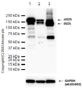 Western blot - Anti-iNOS+nNOS antibody [EP16634] (AB202417)
