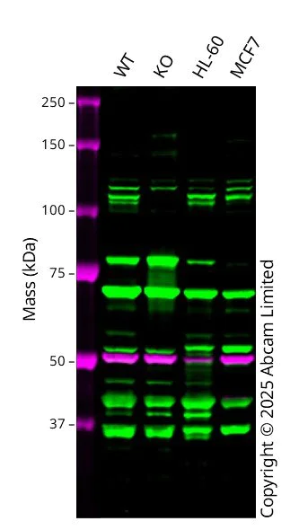 Western blot - Anti-INPP4A antibody [EP3425(2)] (AB109622)