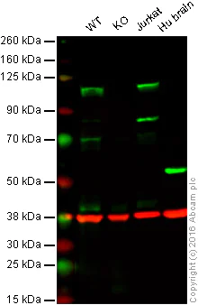 Western blot - Anti-INPP4A antibody [EP3425(2)] (AB109622)