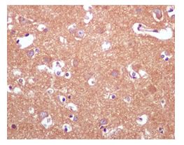 Immunohistochemistry (Formalin/PFA-fixed paraffin-embedded sections) - Anti-INPP4A antibody [EP3425(2)] - BSA and Azide free (AB247910), expandable thumbnail