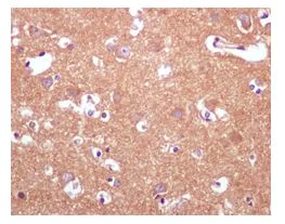 Immunohistochemistry (Formalin/PFA-fixed paraffin-embedded sections) - Anti-INPP4A antibody [EP3425(2)] - BSA and Azide free (AB247910)