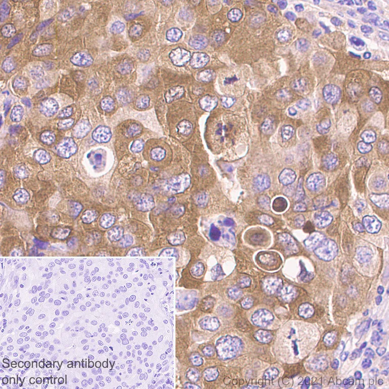 Immunohistochemistry (Formalin/PFA-fixed paraffin-embedded sections) - Anti-INPP4B antibody [EPR3108Y] (AB81269)