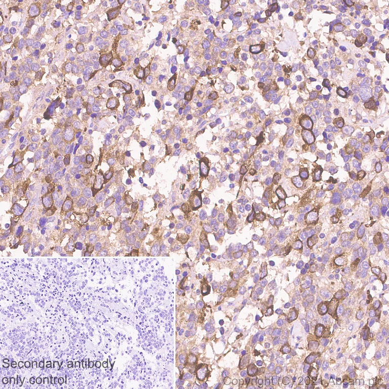 Immunohistochemistry (Formalin/PFA-fixed paraffin-embedded sections) - Anti-INPP4B antibody [EPR3108Y] (AB81269)