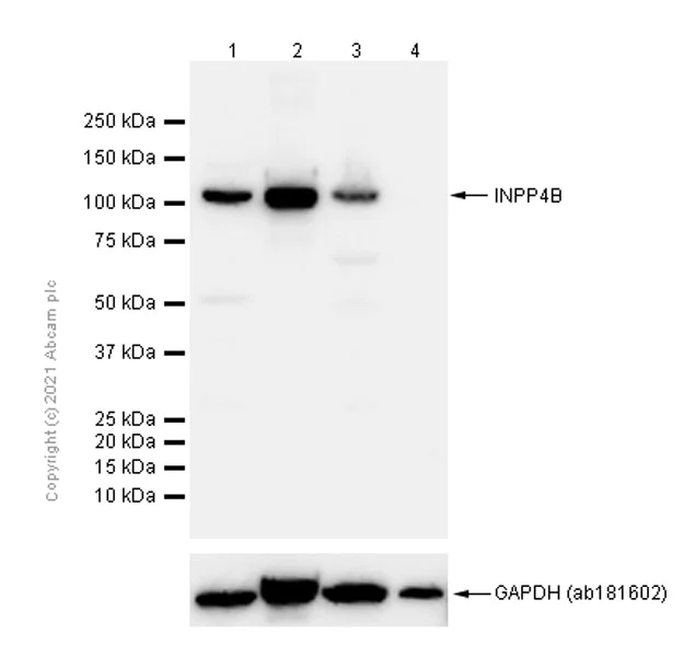 Western blot - Anti-INPP4B antibody [EPR3108Y] (AB81269)