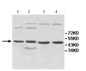 Western blot - Anti-INPP5A antibody (AB118418), expandable thumbnail