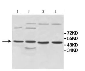 Western blot - Anti-INPP5A antibody (AB118418)