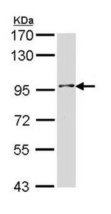 Western blot - Anti-INPP5B antibody (AB95995)