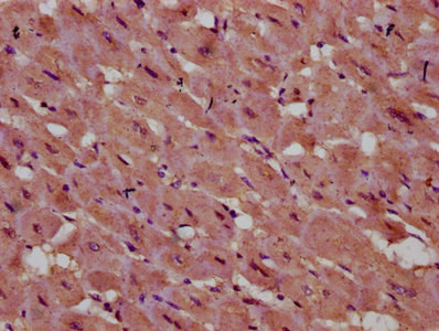 Immunohistochemistry (Formalin/PFA-fixed paraffin-embedded sections) - Anti-INPP5E antibody (AB236108)