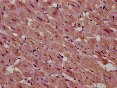 Immunohistochemistry (Formalin/PFA-fixed paraffin-embedded sections) - Anti-INPP5E antibody (AB236108)