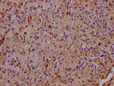 Immunohistochemistry (Formalin/PFA-fixed paraffin-embedded sections) - Anti-INPP5E antibody (AB236108)
