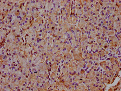 Immunohistochemistry (Formalin/PFA-fixed paraffin-embedded sections) - Anti-INPP5E antibody (AB236108)