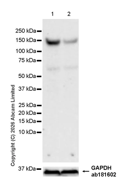 Western blot - Anti-INPP5F antibody [MJF-D29759-51] (AB325711)