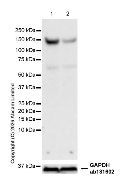Western blot - Anti-INPP5F antibody [MJF-D29759-51] - BSA and Azide free (AB326359)