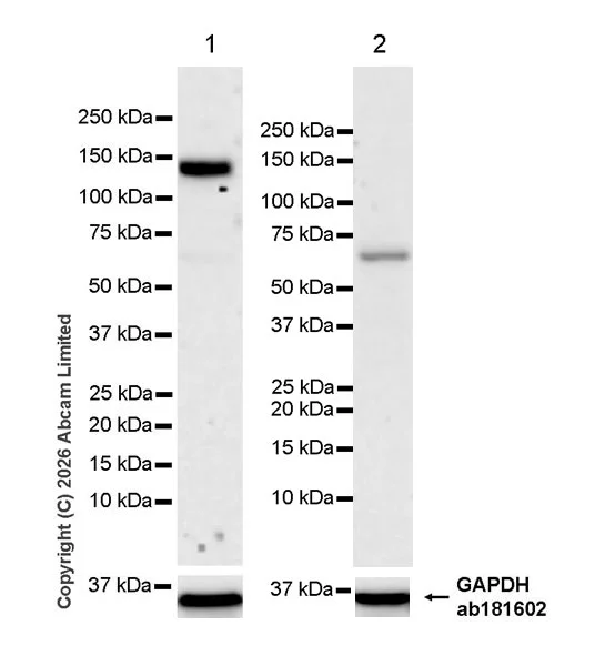 Western blot - Anti-INPP5F antibody [MJF-D29759-51] - BSA and Azide free (AB326359)