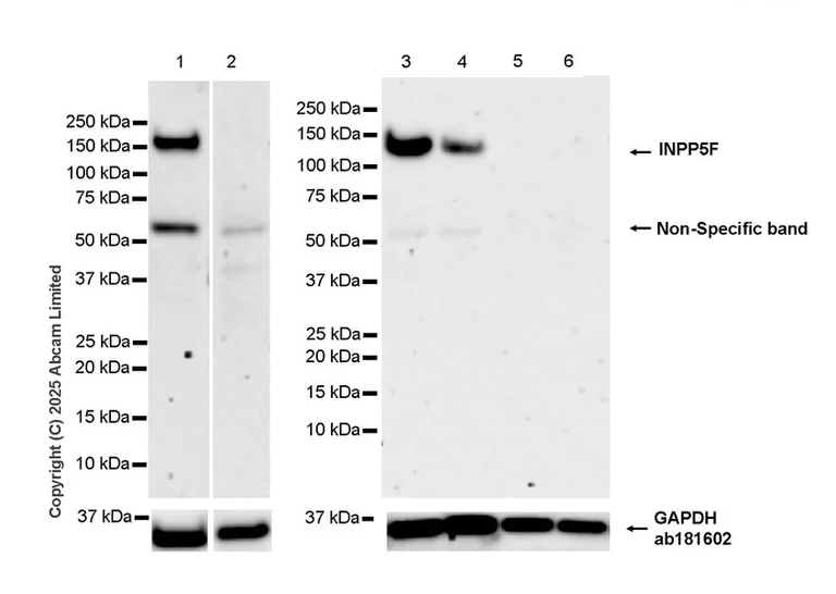 Western blot - Anti-INPP5F antibody [MJF-D29759-51] - BSA and Azide free (AB326359)
