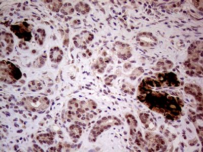 Immunohistochemistry (Formalin/PFA-fixed paraffin-embedded sections) - Anti-INPP5F antibody [OTI1D4] (AB236391)