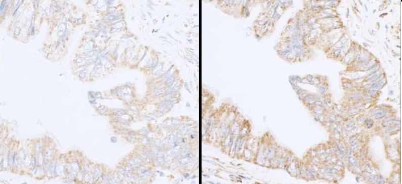 Immunohistochemistry (Formalin/PFA-fixed paraffin-embedded sections) - Anti-INPPL1/SHIP-2 antibody (AB70267)
