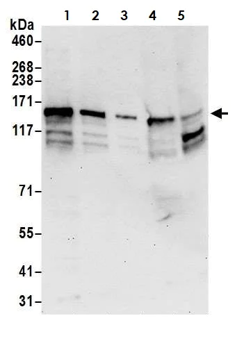 Western blot - Anti-INPPL1/SHIP-2 antibody (AB70267)