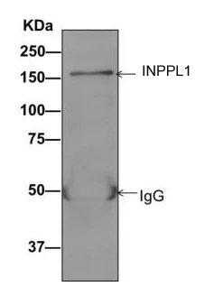 Immunoprecipitation - Anti-INPPL1/SHIP-2 antibody [EPR10954] (AB157460)