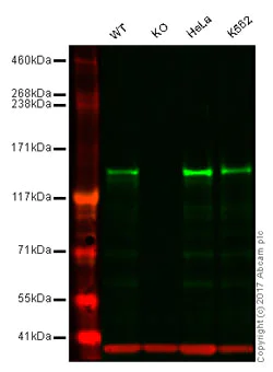 Western blot - Anti-INPPL1/SHIP-2 antibody [EPR10954] (AB157460)