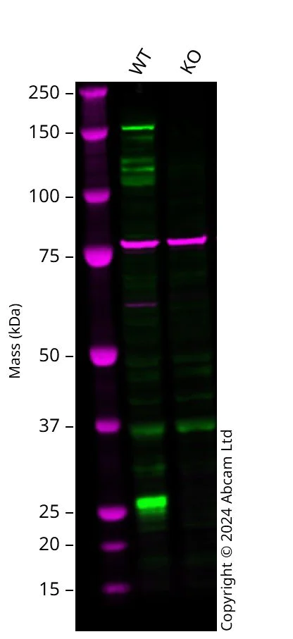 Western blot - Anti-INPPL1/SHIP-2 antibody [EPR10954] (AB157460)