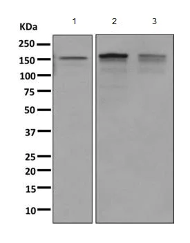 Western blot - Anti-INPPL1/SHIP-2 antibody [EPR10954] (AB157460)