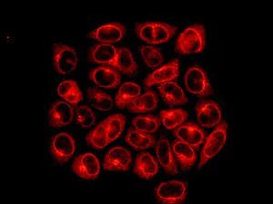 Immunocytochemistry/ Immunofluorescence - Anti-INPPL1/SHIP-2 antibody [EPR10955] (AB166916)