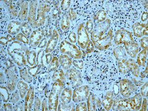Immunohistochemistry (Formalin/PFA-fixed paraffin-embedded sections) - Anti-INPPL1/SHIP-2 antibody [EPR10955] (AB166916)