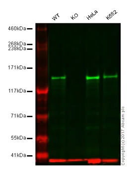 Western blot - Anti-INPPL1/SHIP-2 antibody [EPR10955] - BSA and Azide free (AB249397)