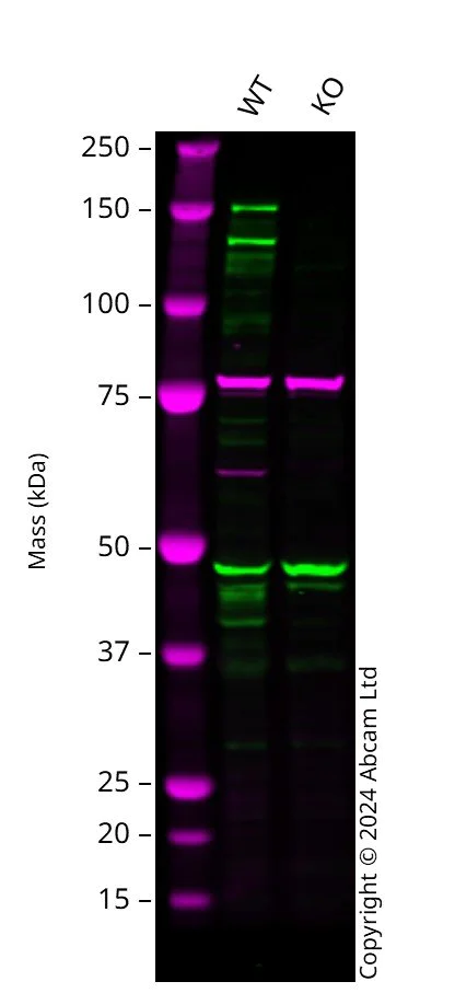Western blot - Anti-INPPL1/SHIP-2 antibody [EPR10955] - BSA and Azide free (AB249397)