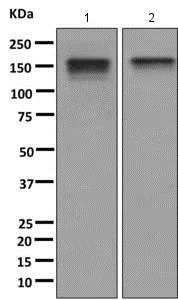 Western blot - Anti-INPPL1/SHIP-2 antibody [EPR10955] - BSA and Azide free (AB249397)